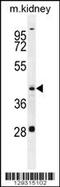 Glutamic-Oxaloacetic Transaminase 1 Like 1 antibody, 56-047, ProSci, Western Blot image 