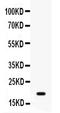 Growth Arrest And DNA Damage Inducible Alpha antibody, PB9945, Boster Biological Technology, Western Blot image 