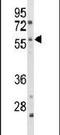 Cytochrome P450 Family 2 Subfamily C Member 19 antibody, PA5-25906, Invitrogen Antibodies, Western Blot image 