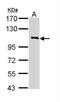 Colony Stimulating Factor 2 Receptor Beta Common Subunit antibody, NBP1-31771, Novus Biologicals, Western Blot image 