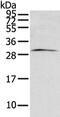 Zinc Finger AN1-Type Containing 2B antibody, PA5-51275, Invitrogen Antibodies, Western Blot image 