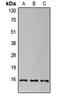 Eukaryotic Translation Initiation Factor 4E Binding Protein 1 antibody, LS-C353980, Lifespan Biosciences, Western Blot image 