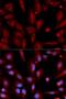 WNT Inhibitory Factor 1 antibody, LS-C334029, Lifespan Biosciences, Immunofluorescence image 