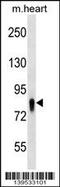 Ubiquitin Associated And SH3 Domain Containing A antibody, 60-363, ProSci, Western Blot image 