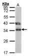 Tetratricopeptide Repeat Domain 1 antibody, TA307951, Origene, Western Blot image 
