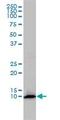 FKBP Prolyl Isomerase 1A antibody, ab58072, Abcam, Western Blot image 
