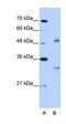 Eukaryotic Translation Initiation Factor 4H antibody, orb324920, Biorbyt, Western Blot image 
