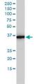 Methylenetetrahydrofolate Dehydrogenase (NADP+ Dependent) 2, Methenyltetrahydrofolate Cyclohydrolase antibody, H00010797-M01, Novus Biologicals, Western Blot image 