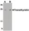 Transthyretin antibody, PA5-20742, Invitrogen Antibodies, Western Blot image 