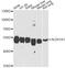 Aldehyde Dehydrogenase 1 Family Member A1 antibody, A1802, ABclonal Technology, Western Blot image 