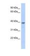 Mediator Complex Subunit 8 antibody, NBP1-55435, Novus Biologicals, Western Blot image 