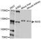 Inversin antibody, A10298, ABclonal Technology, Western Blot image 