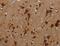 Lysine Methyltransferase 2B antibody, MBS2529407, MyBioSource, Immunohistochemistry frozen image 