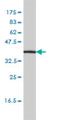 Interleukin 11 Receptor Subunit Alpha antibody, H00003590-M01, Novus Biologicals, Western Blot image 