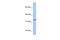 Acyl-CoA Binding Domain Containing 4 antibody, PA5-43439, Invitrogen Antibodies, Western Blot image 