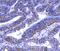 Claudin 7 antibody, A03851-3, Boster Biological Technology, Immunohistochemistry paraffin image 