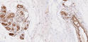 Ubiquitin Conjugating Enzyme E2 L6 antibody, NBP1-04351, Novus Biologicals, Immunohistochemistry frozen image 