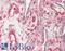 Collagen Type IV Alpha 1 Chain antibody, LS-C318998, Lifespan Biosciences, Immunohistochemistry paraffin image 