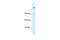 AT-Rich Interaction Domain 4A antibody, GTX45913, GeneTex, Western Blot image 