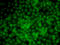 Uridine Monophosphate Synthetase antibody, LS-C346087, Lifespan Biosciences, Immunofluorescence image 