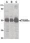 Tripartite Motif Containing 5 antibody, PA5-20050, Invitrogen Antibodies, Western Blot image 