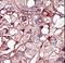 Activin A Receptor Like Type 1 antibody, LS-C97153, Lifespan Biosciences, Immunohistochemistry frozen image 