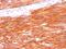 c-Kit antibody, NBP2-29423, Novus Biologicals, Immunohistochemistry frozen image 