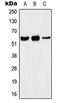 Potassium Voltage-Gated Channel Subfamily A Member 5 antibody, MBS820910, MyBioSource, Western Blot image 