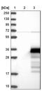 Zinc Finger CCHC-Type Containing 24 antibody, NBP1-88536, Novus Biologicals, Western Blot image 