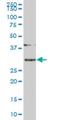 Stem-Loop Binding Protein antibody, H00007884-M01, Novus Biologicals, Western Blot image 