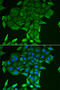 CD84 Molecule antibody, STJ28516, St John