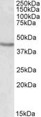 MLLT10 Histone Lysine Methyltransferase DOT1L Cofactor antibody, 42-566, ProSci, Western Blot image 