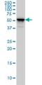 Keratin 4 antibody, H00003851-M01, Novus Biologicals, Western Blot image 