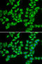 Hydroxyacyl-CoA Dehydrogenase Trifunctional Multienzyme Complex Subunit Beta antibody, STJ28284, St John