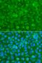 Serpin Family A Member 3 antibody, GTX55503, GeneTex, Immunocytochemistry image 