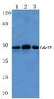 Cell Division Cycle 37 antibody, A02169, Boster Biological Technology, Western Blot image 