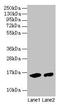 Hemoglobin Subunit Alpha 2 antibody, LS-B12169, Lifespan Biosciences, Western Blot image 