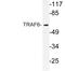 TNF Receptor Associated Factor 6 antibody, LS-C291750, Lifespan Biosciences, Western Blot image 