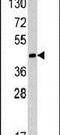 RAD9 Checkpoint Clamp Component A antibody, PA5-13374, Invitrogen Antibodies, Western Blot image 