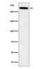 Huntingtin antibody, M00134, Boster Biological Technology, Western Blot image 