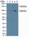 Serine/threonine-protein kinase D1 antibody, LS-C721554, Lifespan Biosciences, Western Blot image 