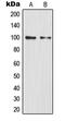 Nuclear Factor Kappa B Subunit 2 antibody, MBS820151, MyBioSource, Western Blot image 