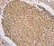 Ring Finger Protein 148 antibody, PA5-50745, Invitrogen Antibodies, Immunohistochemistry paraffin image 