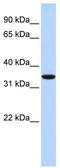 RING finger protein 171 antibody, TA329872, Origene, Western Blot image 