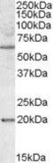 BCL2 Associated Athanogene 4 antibody, GTX88531, GeneTex, Western Blot image 