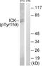 Intestinal Cell Kinase antibody, PA5-39739, Invitrogen Antibodies, Western Blot image 