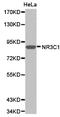 Nuclear Receptor Subfamily 3 Group C Member 1 antibody, LS-C192786, Lifespan Biosciences, Western Blot image 