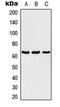 T-Box 18 antibody, LS-C353125, Lifespan Biosciences, Western Blot image 