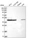 Succinyl-CoA ligase [ADP-forming] subunit beta, mitochondrial antibody, PA5-65238, Invitrogen Antibodies, Western Blot image 