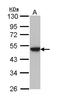 Keratin 31 antibody, LS-C186271, Lifespan Biosciences, Western Blot image 